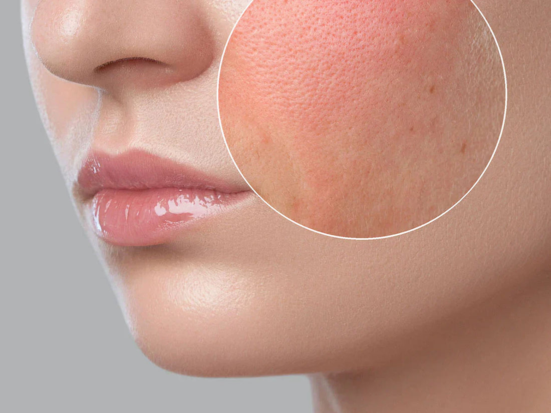 https://aab.com.pk/products/e-derm-gel