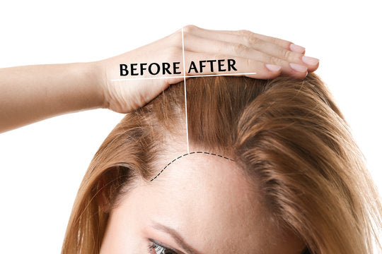 SECCONIL HG Hair Growth Shampoo