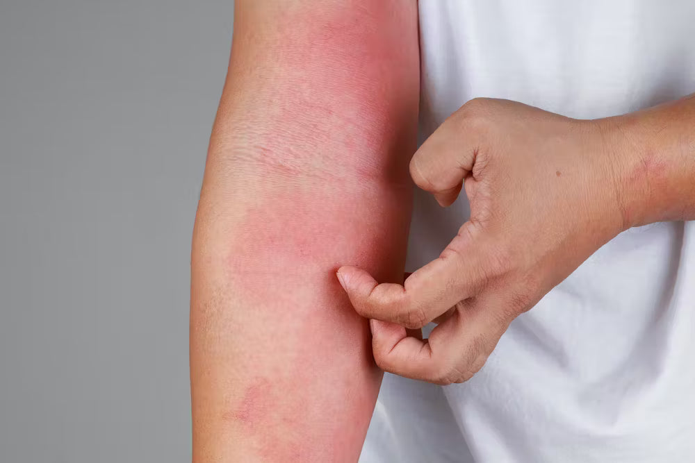 https://aab.com.pk/products/d-care-lotion