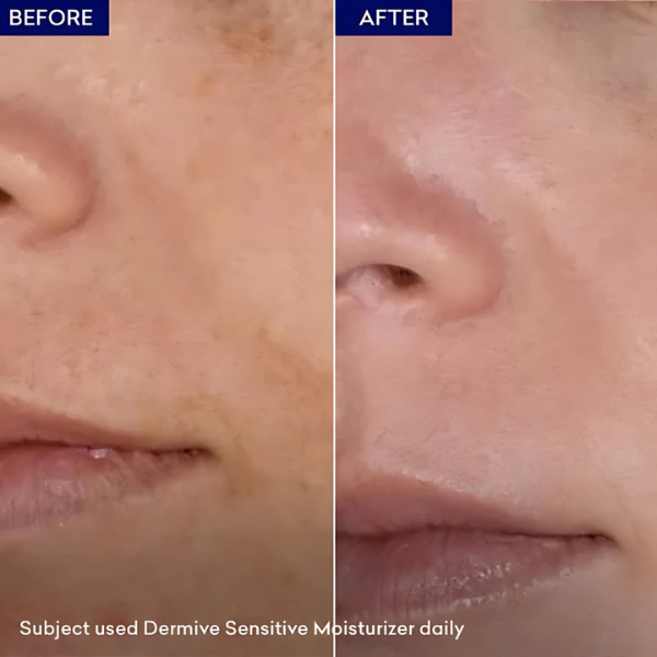 Dermive Sensitive Moisturizer 